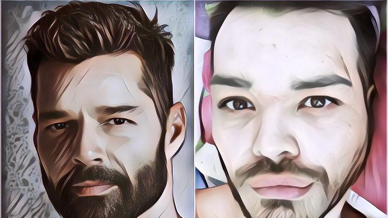 Demi Bisa Mirip Ricky Martin Pria Ini Malah Nekat Injeksi Oli ke Wajahnya