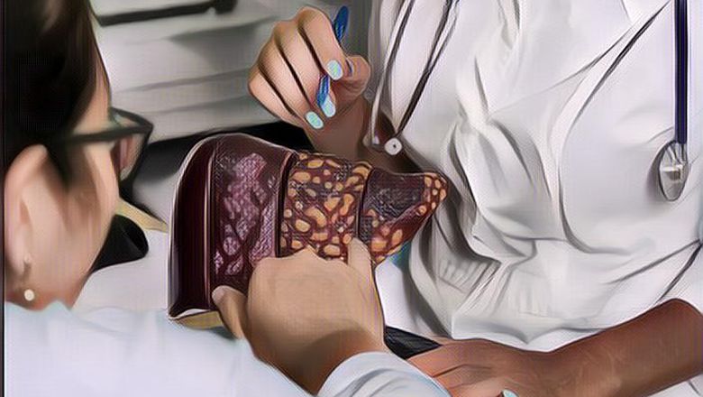 Apa itu Penyakit Sirosis Hati dan Apa&nbsp;Gejalanya