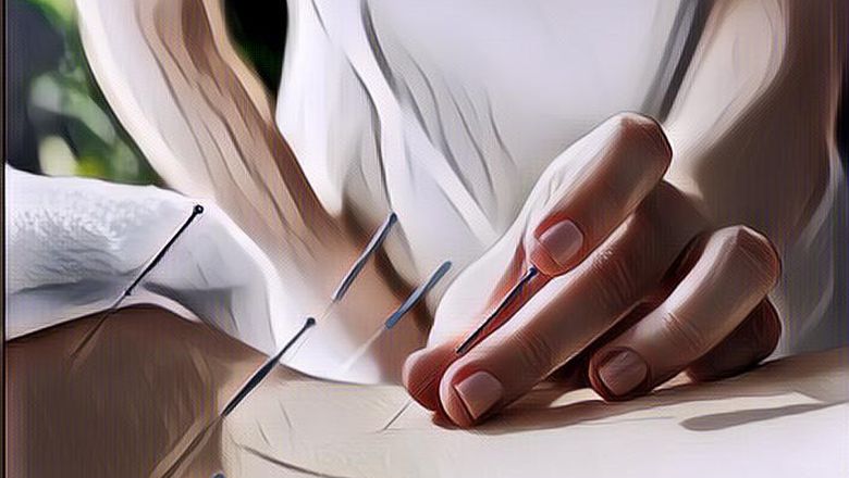 Bagaimana Cara Kerja Akupuntur dan Apa Manfaatnya untuk&nbsp;Kesehatan